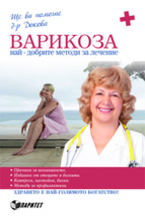 Варикоза - най-добрите методи за лечение