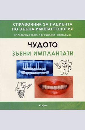 Книга - Чудото зъбни импланти